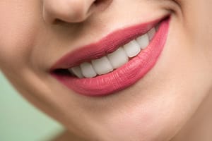 3 Options to Fix Crowded Teeth in Adults